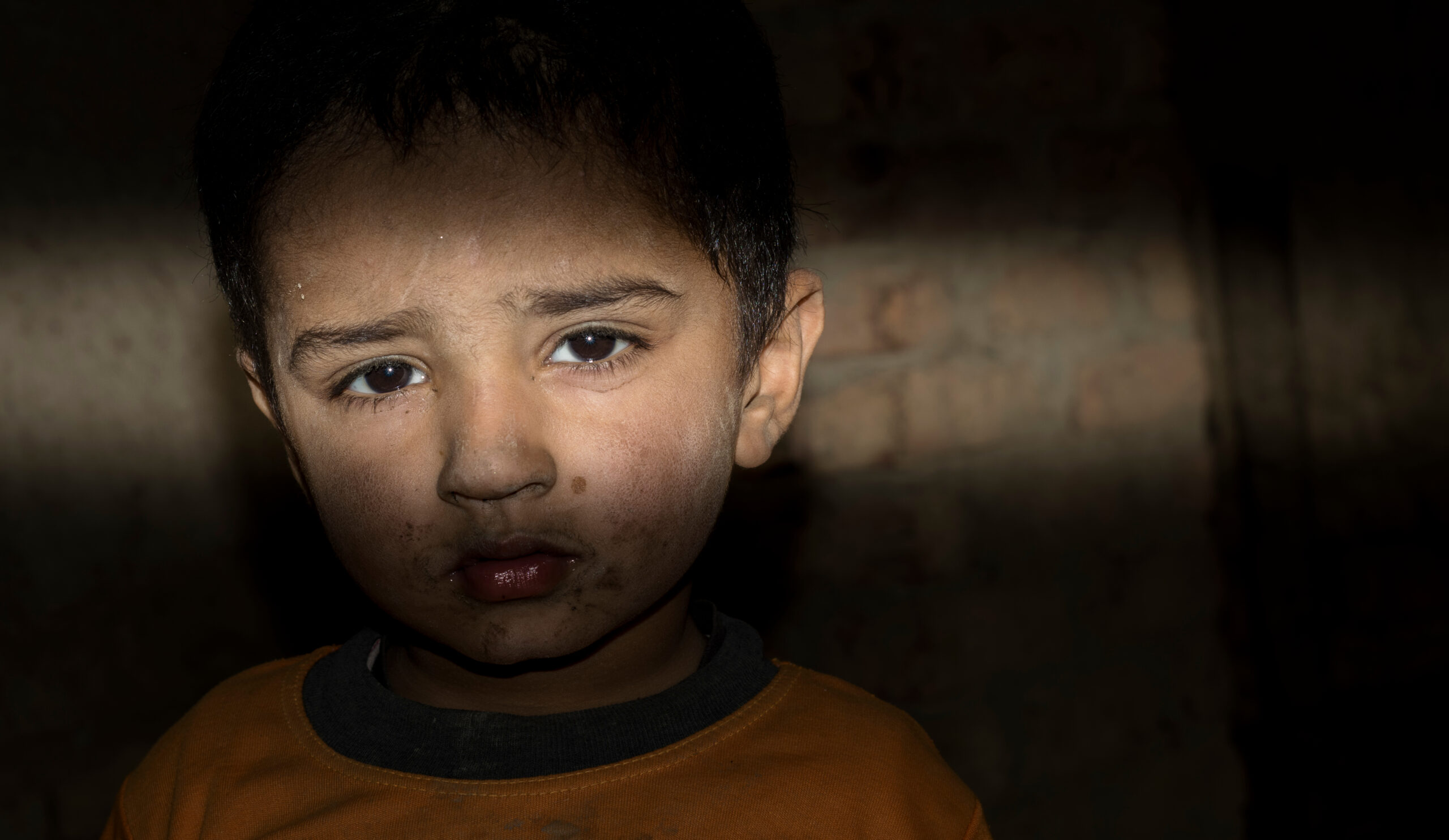 Adverse effects of global economic instability on children