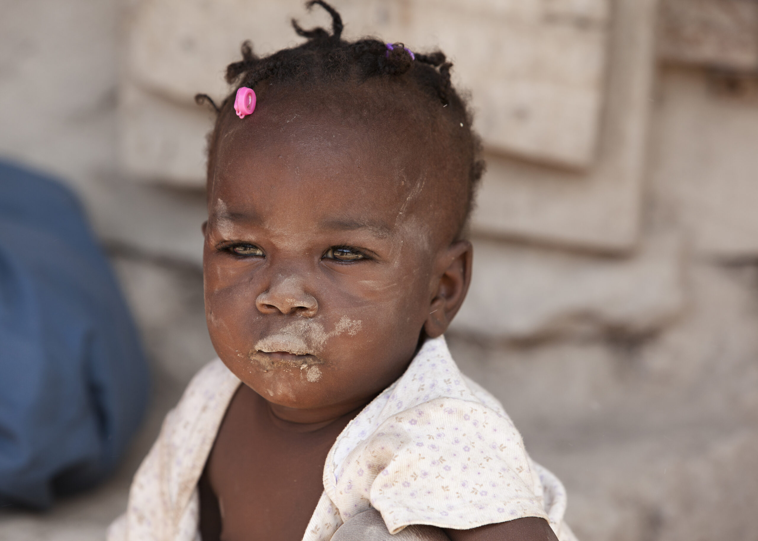Children facing famine: an unprecedented food crisis in Haiti